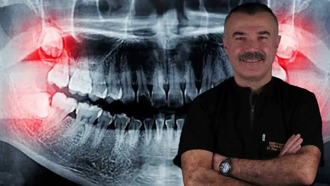 Uzmanı Uyardı: Gülüşünüz Bozulabilir