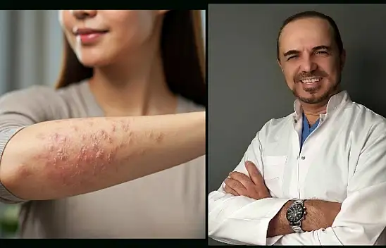 Kışın Sıcak Su İle Banyo Yapmak Egzamayı Artırabilir
