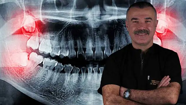 Uzmanı Uyardı: Gülüşünüz Bozulabilir